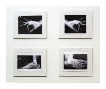 webster_sharon_my_stitched_hand_and_feet_2019_mixed_media_-_4_laminated_x-rays_with_red_thread_on_painted_wood_35_in_x_44_in_1000.jpg