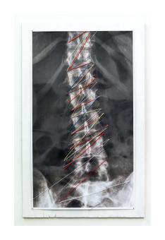webster_sharon_my_stitched_spine_2019_enlarged_lamenated_xray_cords_threads_colored_elastic_on_painted_wood_20in_x_32in_framed_800.jpg